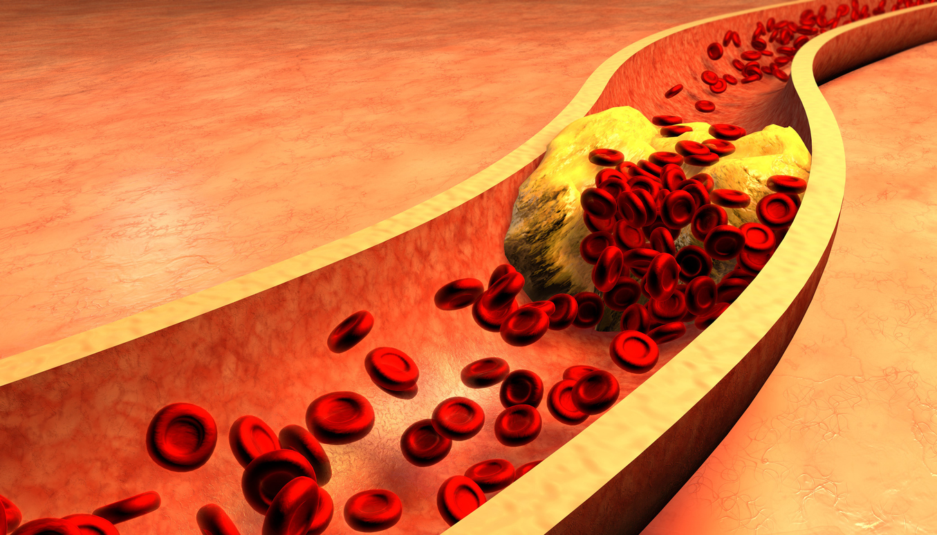 types of cholesterol